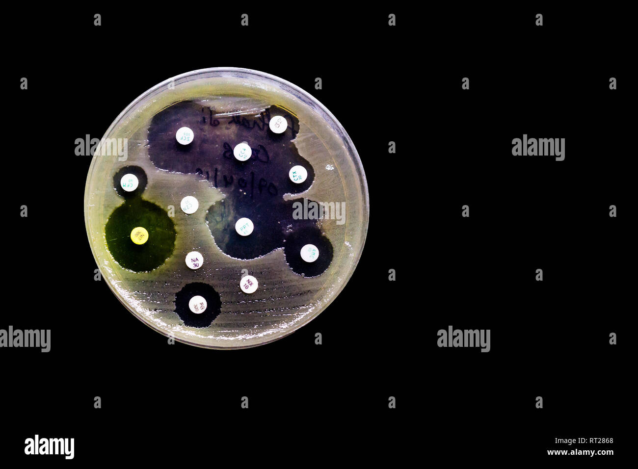 Culture plate of bacterial growth showing antibiotic sensitivity in their colony pattern isolated in black background Stock Photo