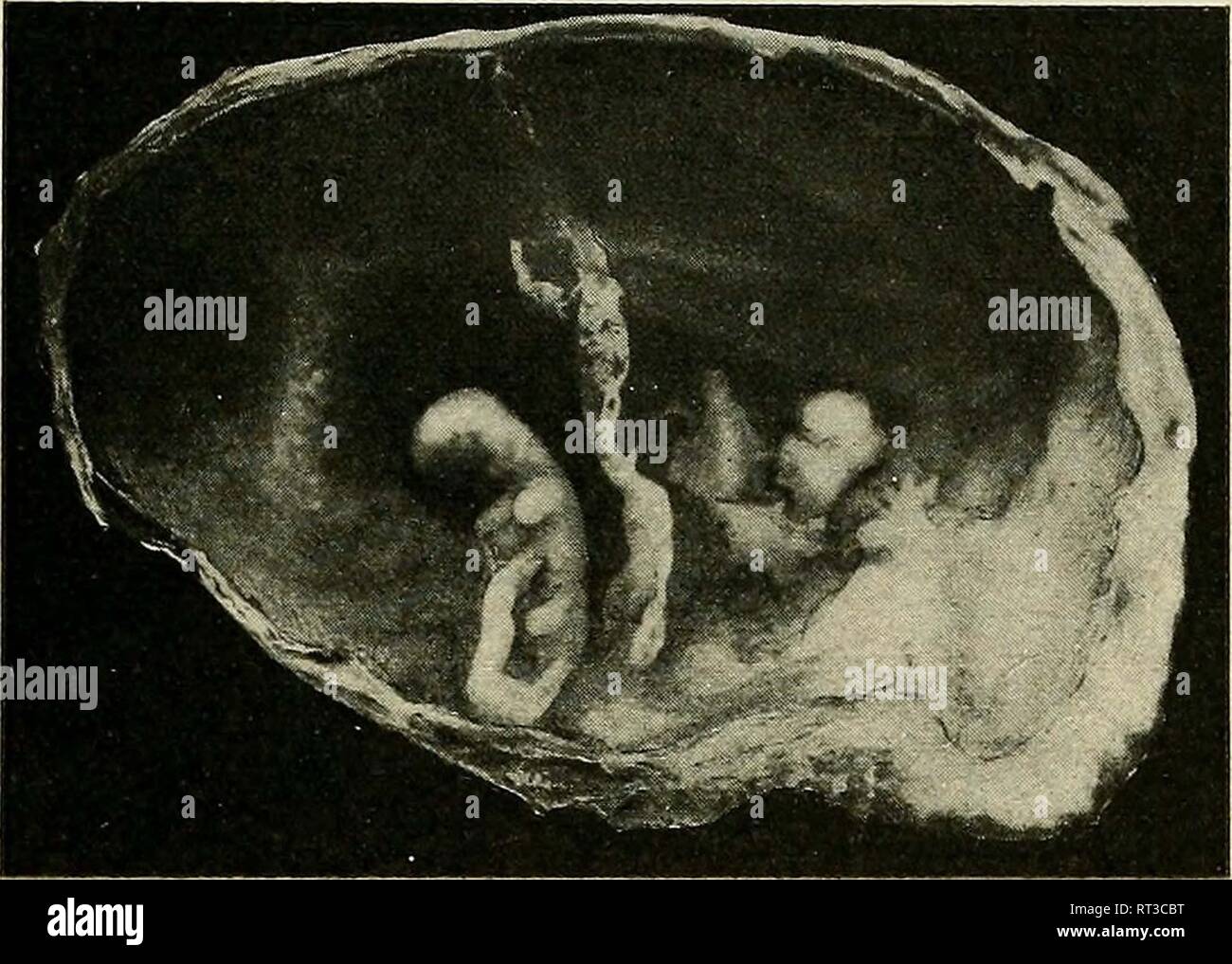 Vintage radiography photo Stock Photo - Alamy
