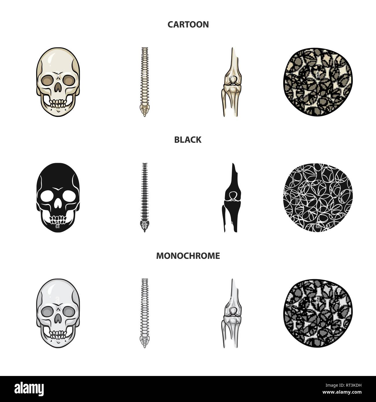 skull,spine,femur,osteoporosis,death,chiropractic,bony,cell,monster ...