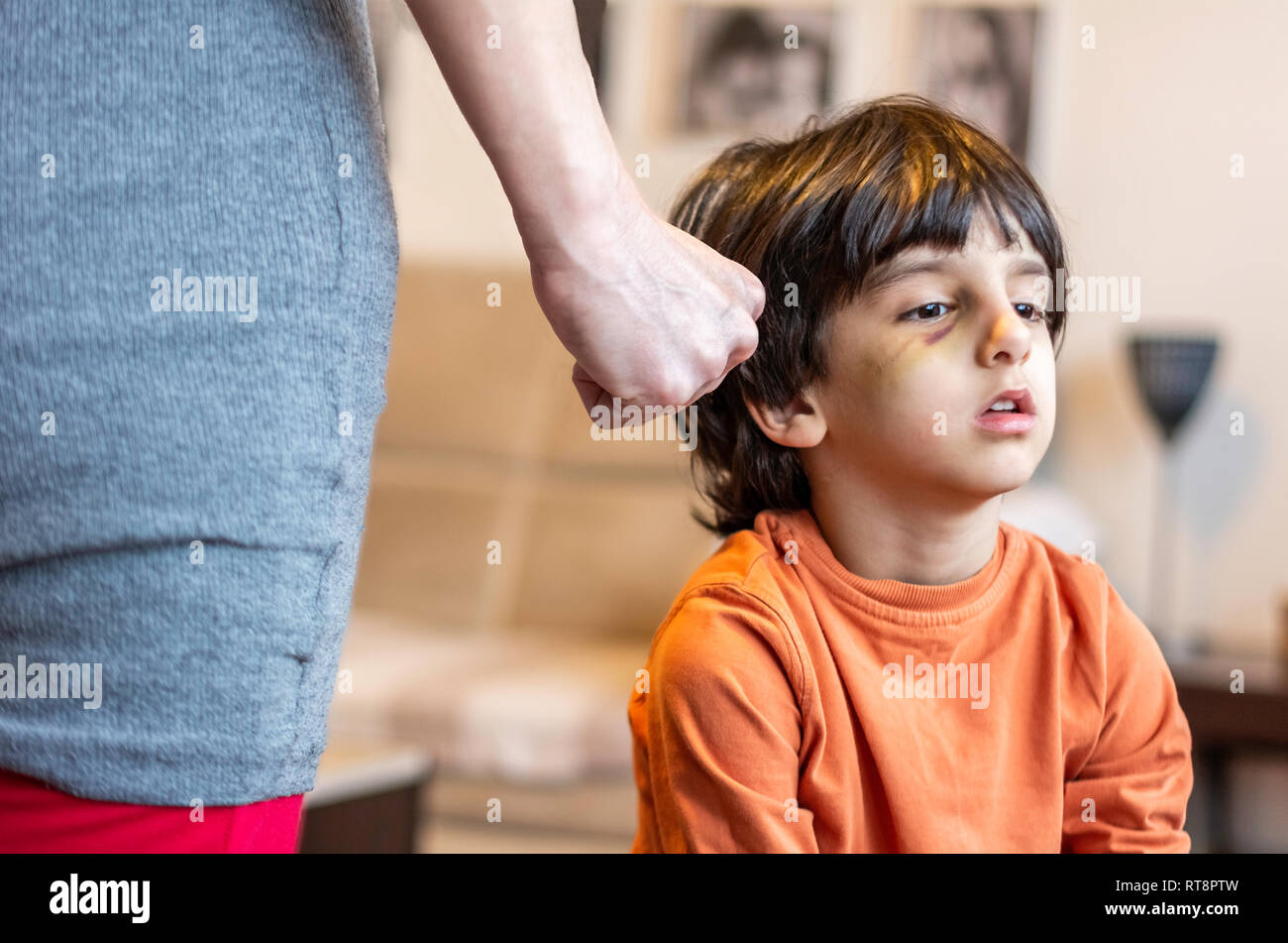 Child abusing concept family violence and aggression - Children abused and scaring - Bruise eye child parent abuse concept Stock Photo