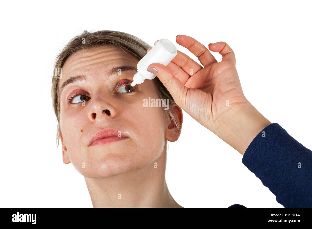 Woman with stye on upper eyelid using medical eye drop on isolated background Stock Photo