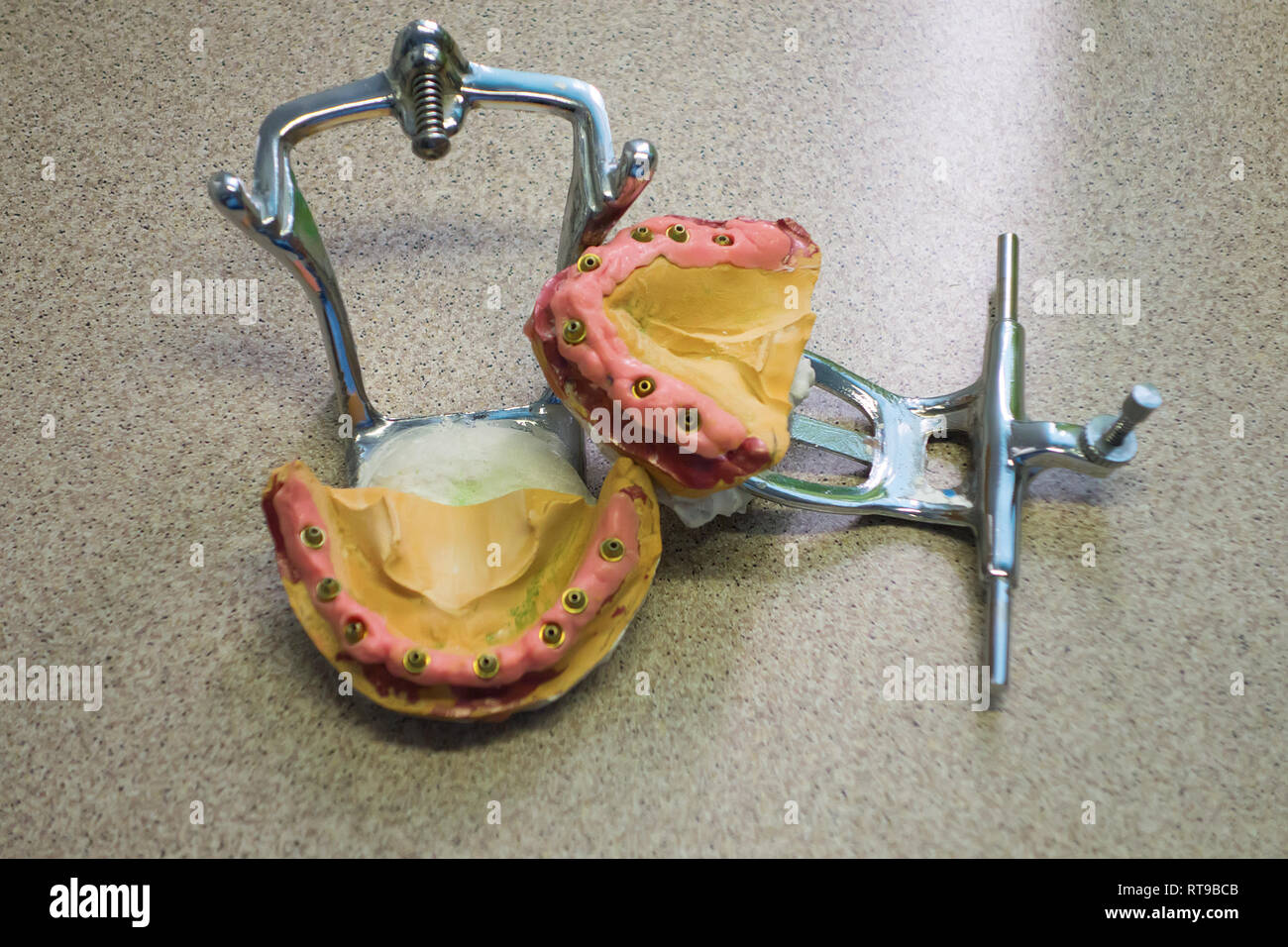the dental plaster model with exposed dental implants Stock Photo Alamy