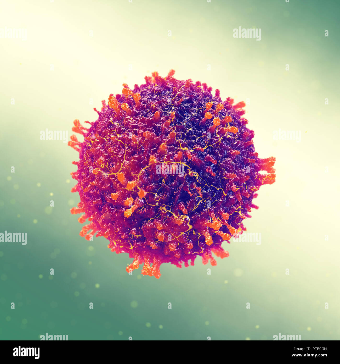 Measles also known as morbilli and rubeola is a highly contagious viral infection, Measles Morbilliviruses Stock Photo