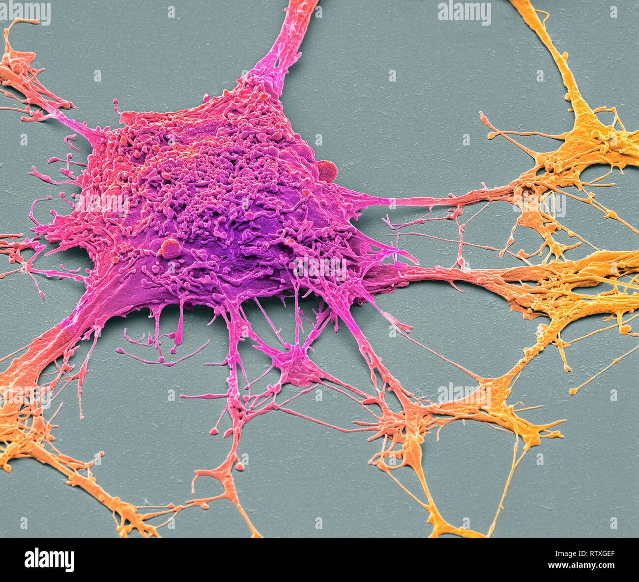 Neurone. Scanning electron micrograph (SEM) of a PC12 neurone in  culture.The PC12 cell line, developed from a pheochromocytoma tumor of the  rat adrena Stock Photo - Alamy