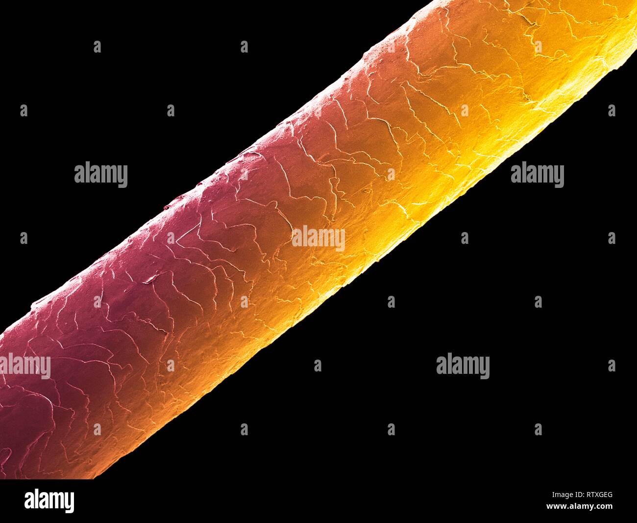 Human hair (Caucasian, brunette), coloured scanning electron micrograph (SEM). The outer layer of hair (the cuticle) has overlapping scales of keratin Stock Photo