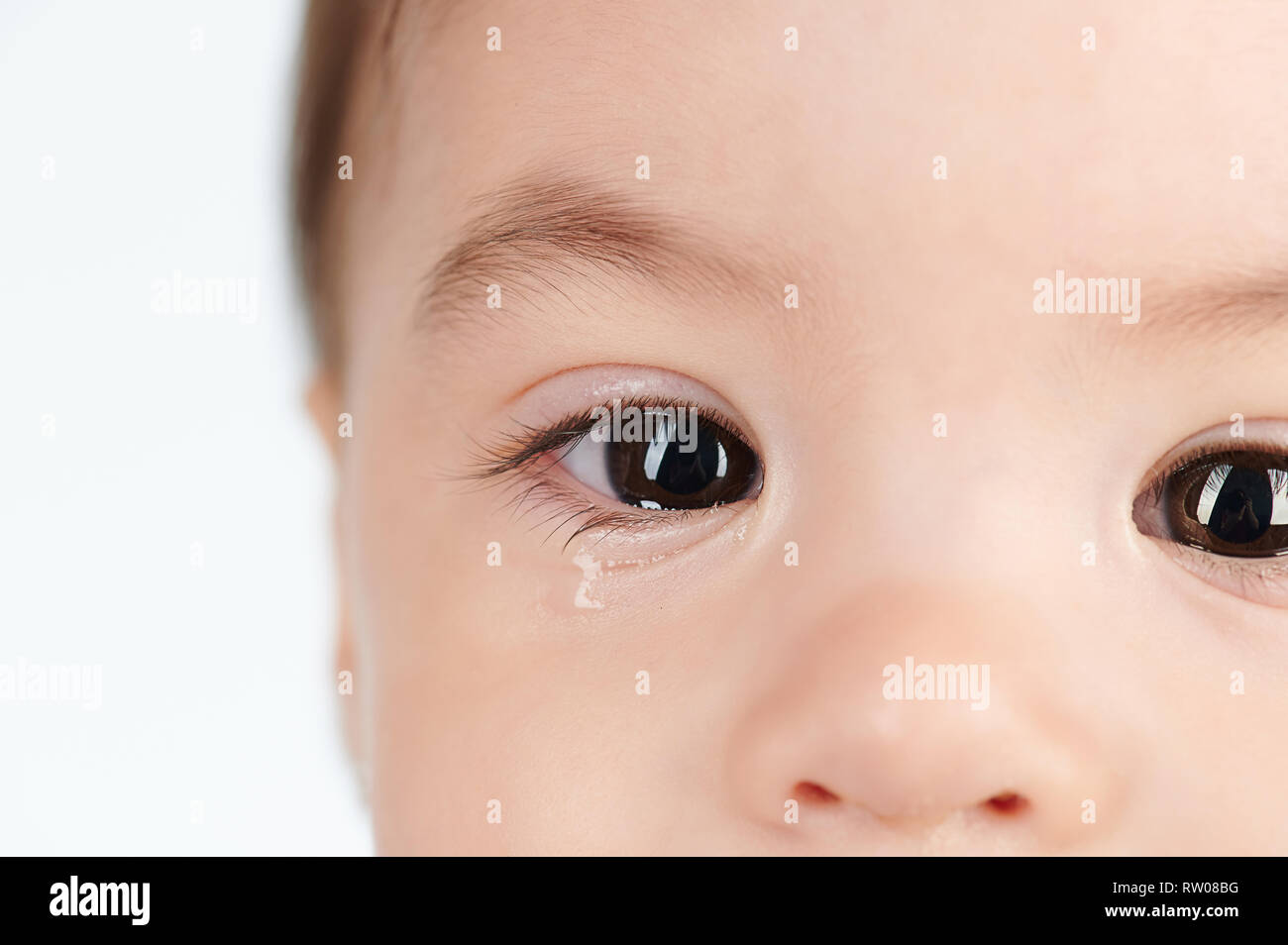 Allergy on baby eye with tear close up view Stock Photo