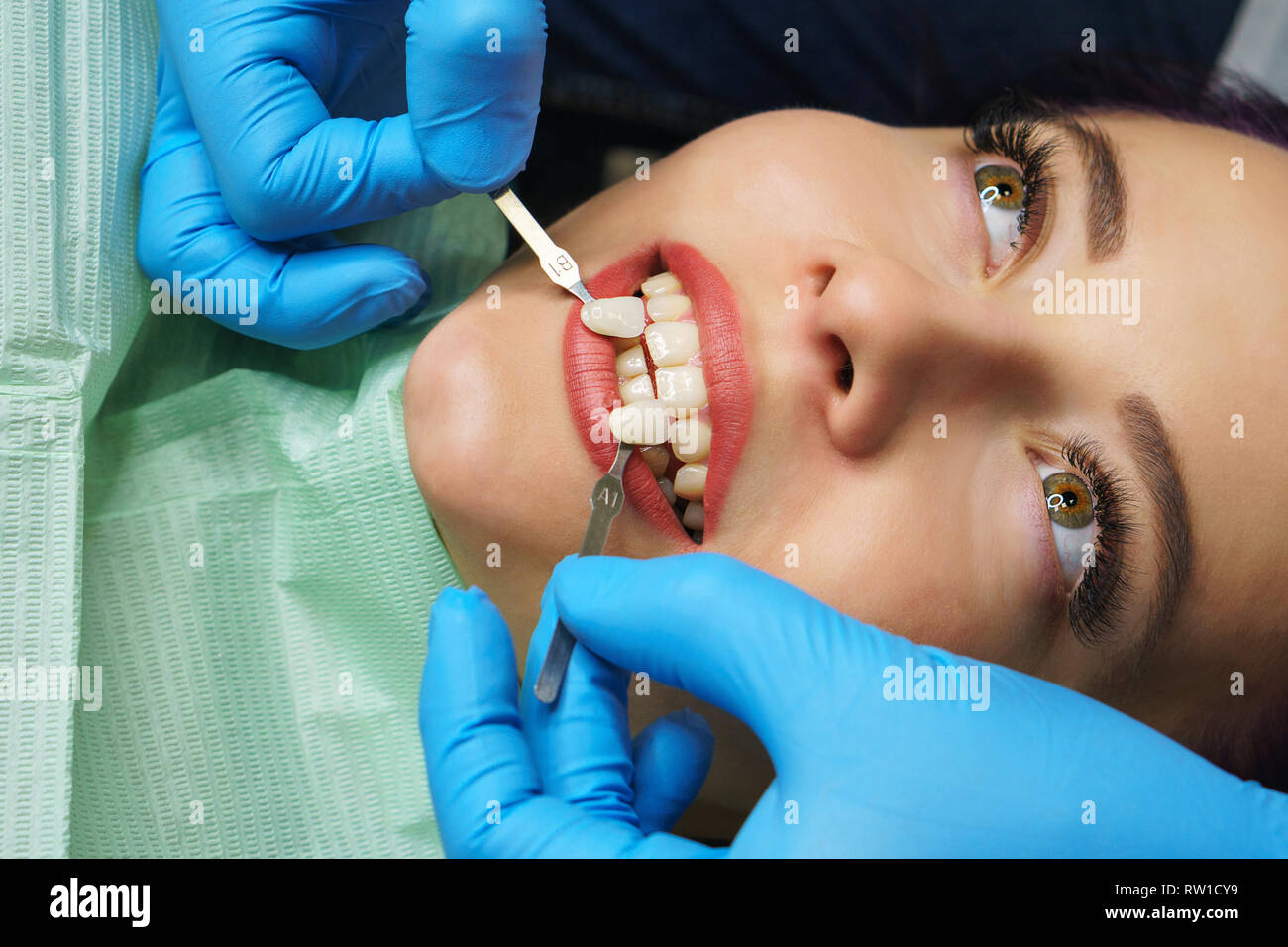 Teeth whitening at dentist. Young girl shows her teeth. White teeth. Dentist picks up shade of