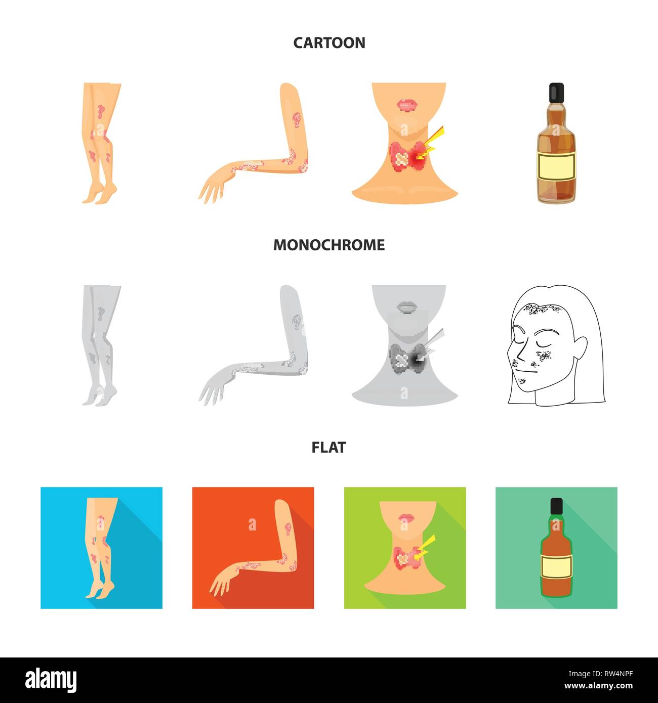 psoriasis,endocrine,body,dermatitis,system,bottle,skin,neck,whiskey ...