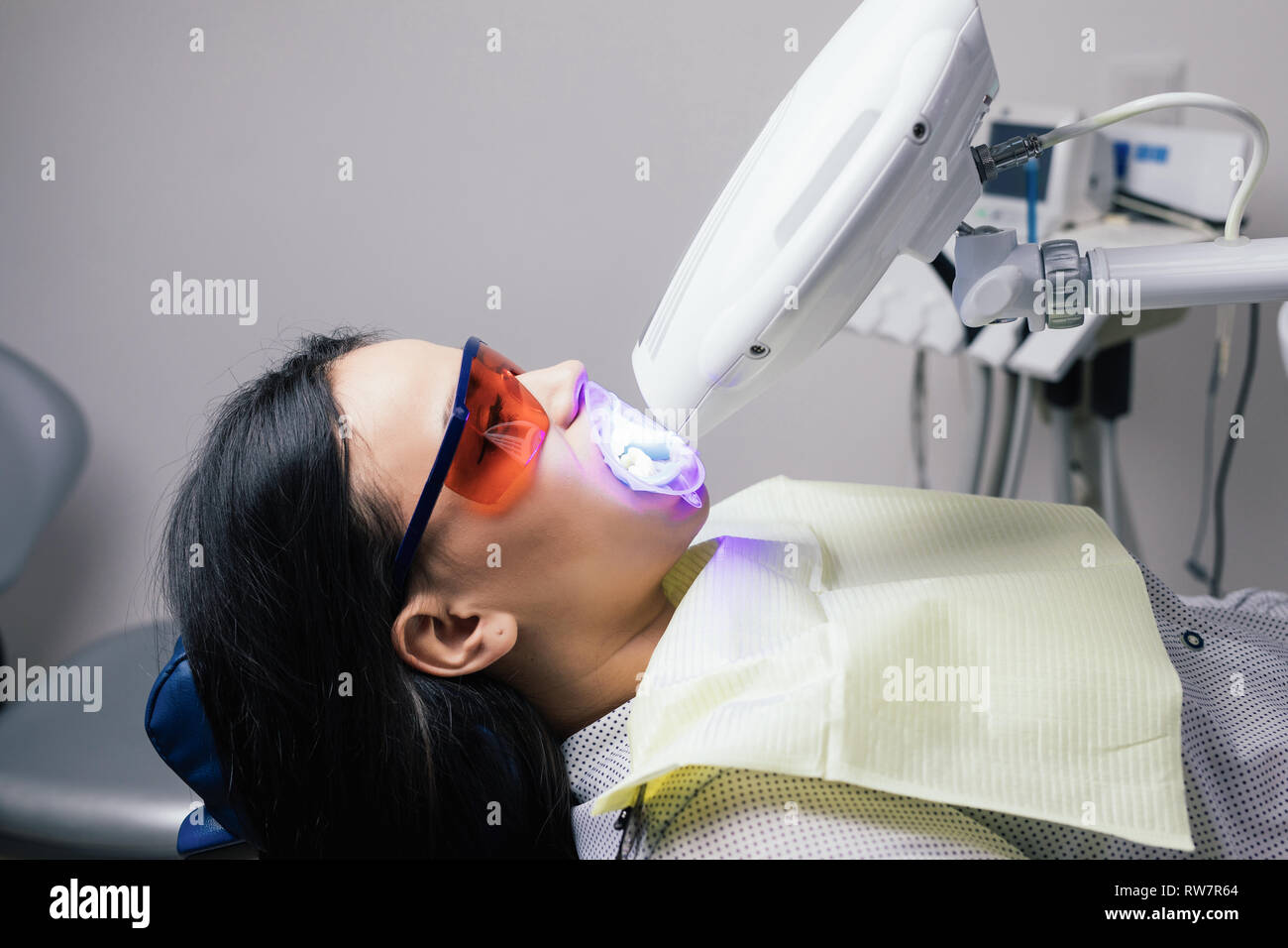 Laser bleaching teeth at dantist room. Teeth whitening for woman. Bleaching of the teeth at dentist clinic Stock Photo