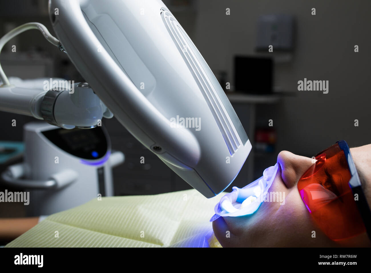 Adult female receiving teeth whitening procedure.portrait of a female