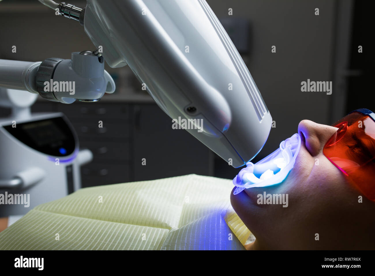 Laser bleaching teeth at dantist room. Teeth whitening for woman