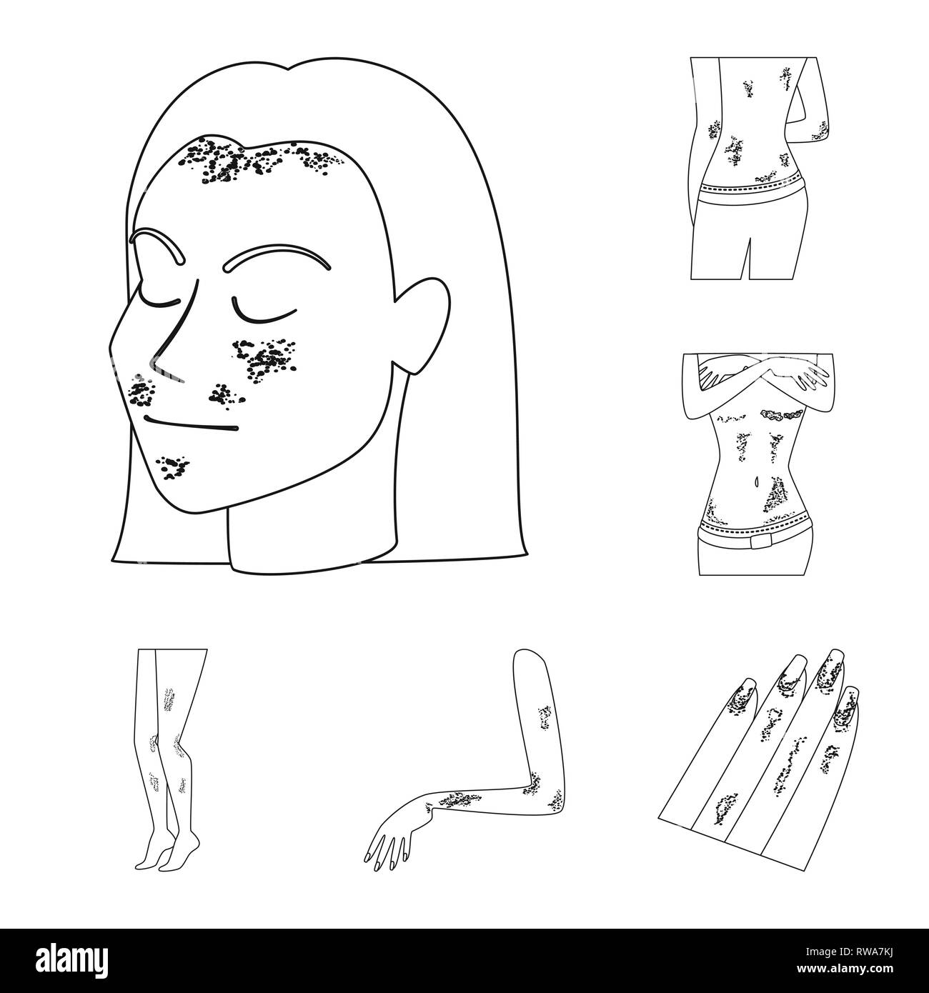 psoriasis,skin,body,dermatitis,stress,allergy,rash,infection,itch ...