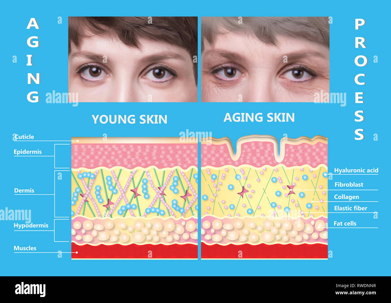 younger skin and aging skin. elastin and collagen Stock Photo Alamy