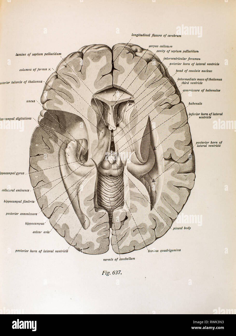 Antique illustration of a dissection of human brain showing occipital ...