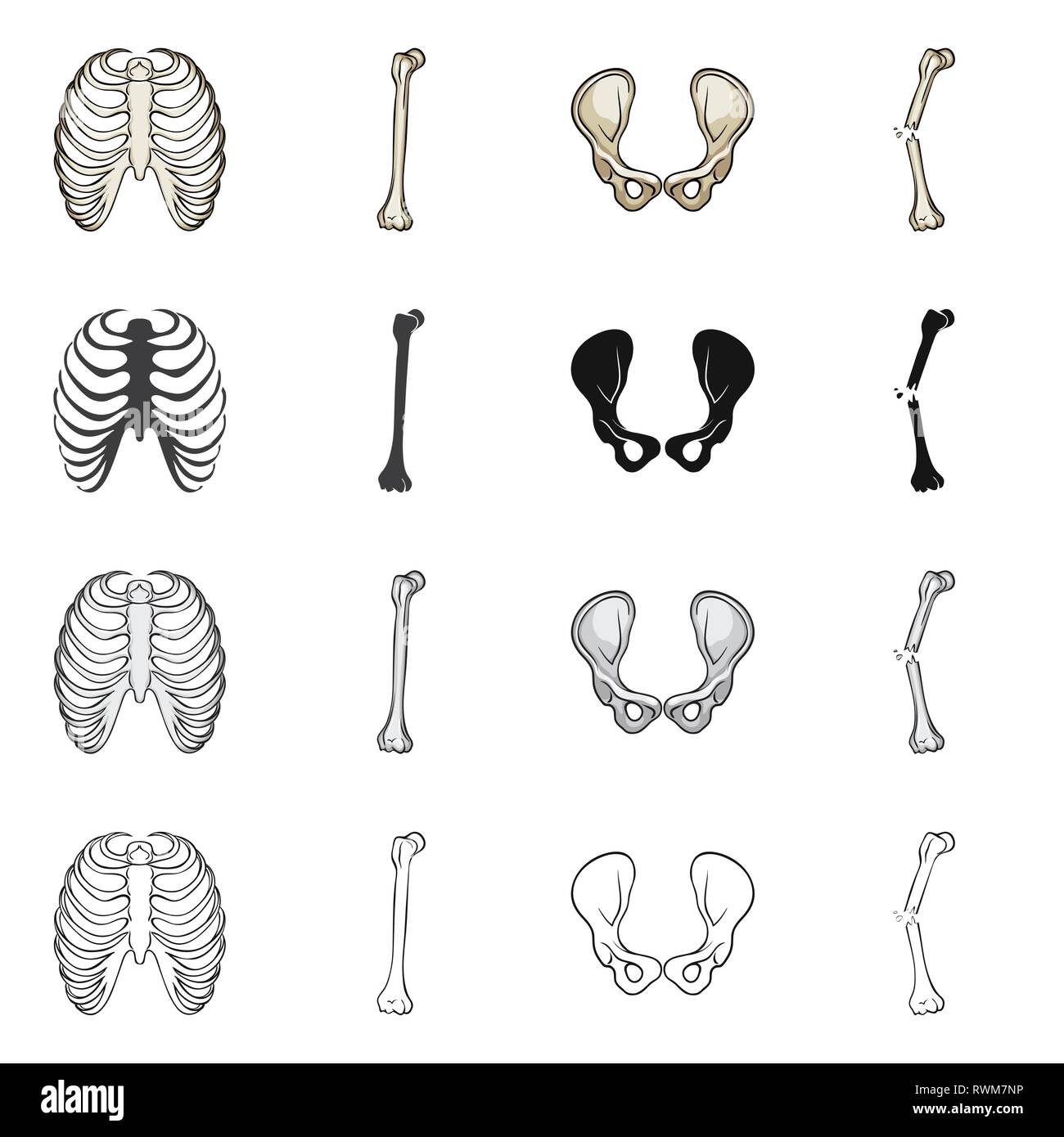 rib,hip,fracture,cage,broken,joint,pain,xray,fibula,pelvis,bias,body