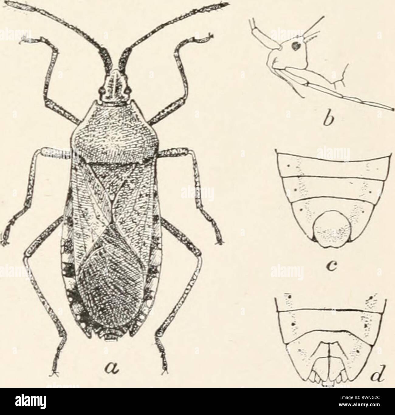Distended abdomen hi-res stock photography and images - Alamy