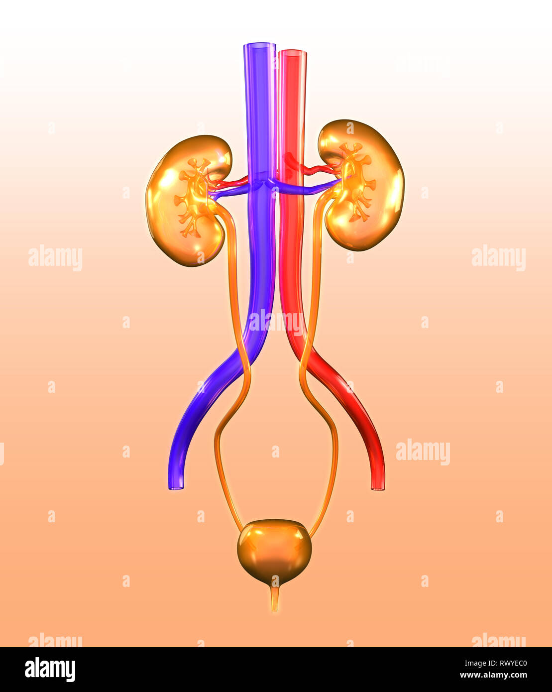 Renal calculi, kidney stone, urinary system of a woman with kidney