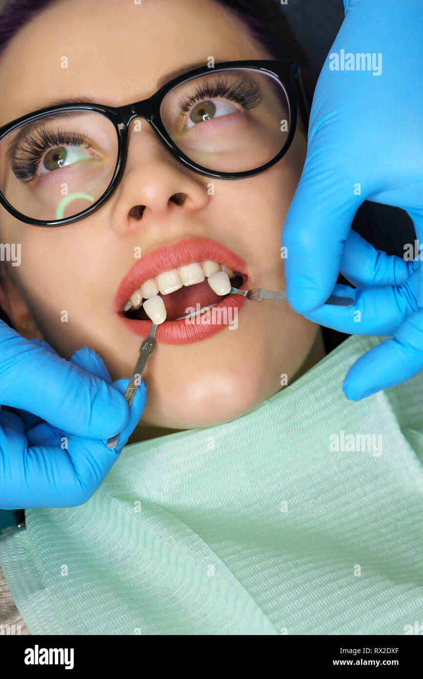 Teeth whitening at dentist. Young woman showing teeth. White teeth