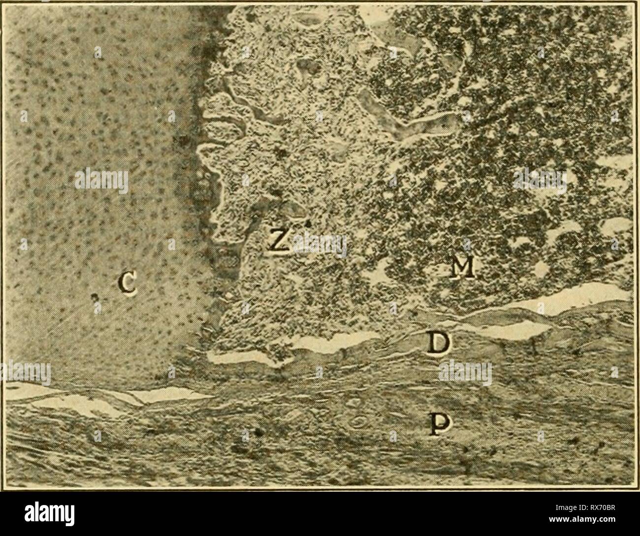 costochondrale Trennung