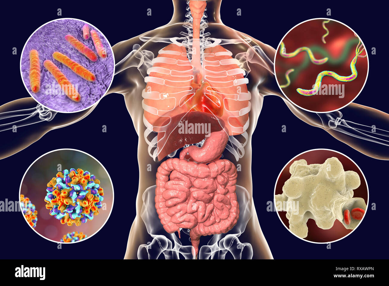 Bacteria that cause human infections, illustration Stock Photo