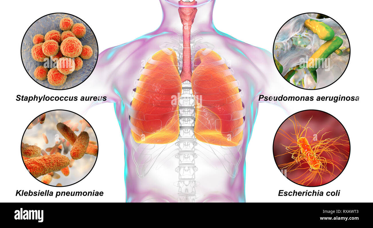 Bacteria that cause nosocomial pneumonia, illustration Stock Photo