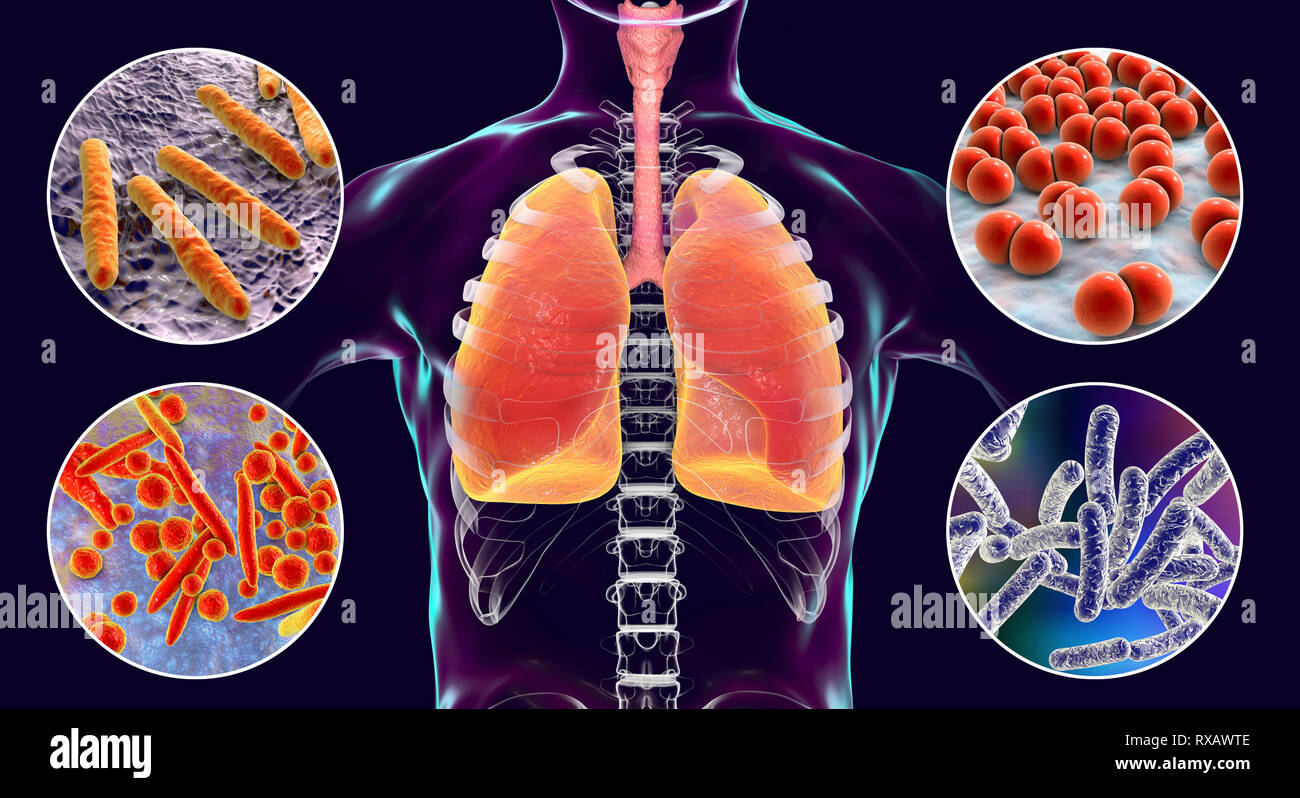 Bacteria that cause lung infections, illustration Stock Photo