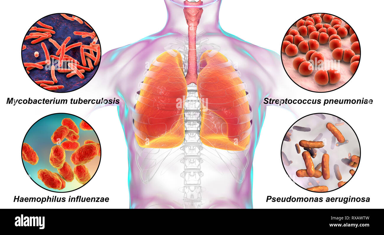 Bacteria that cause lung infections, illustration Stock Photo Alamy