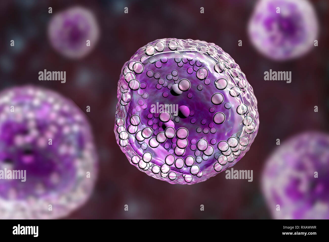 Burkitt's lymphoma cells, illustration Stock Photo