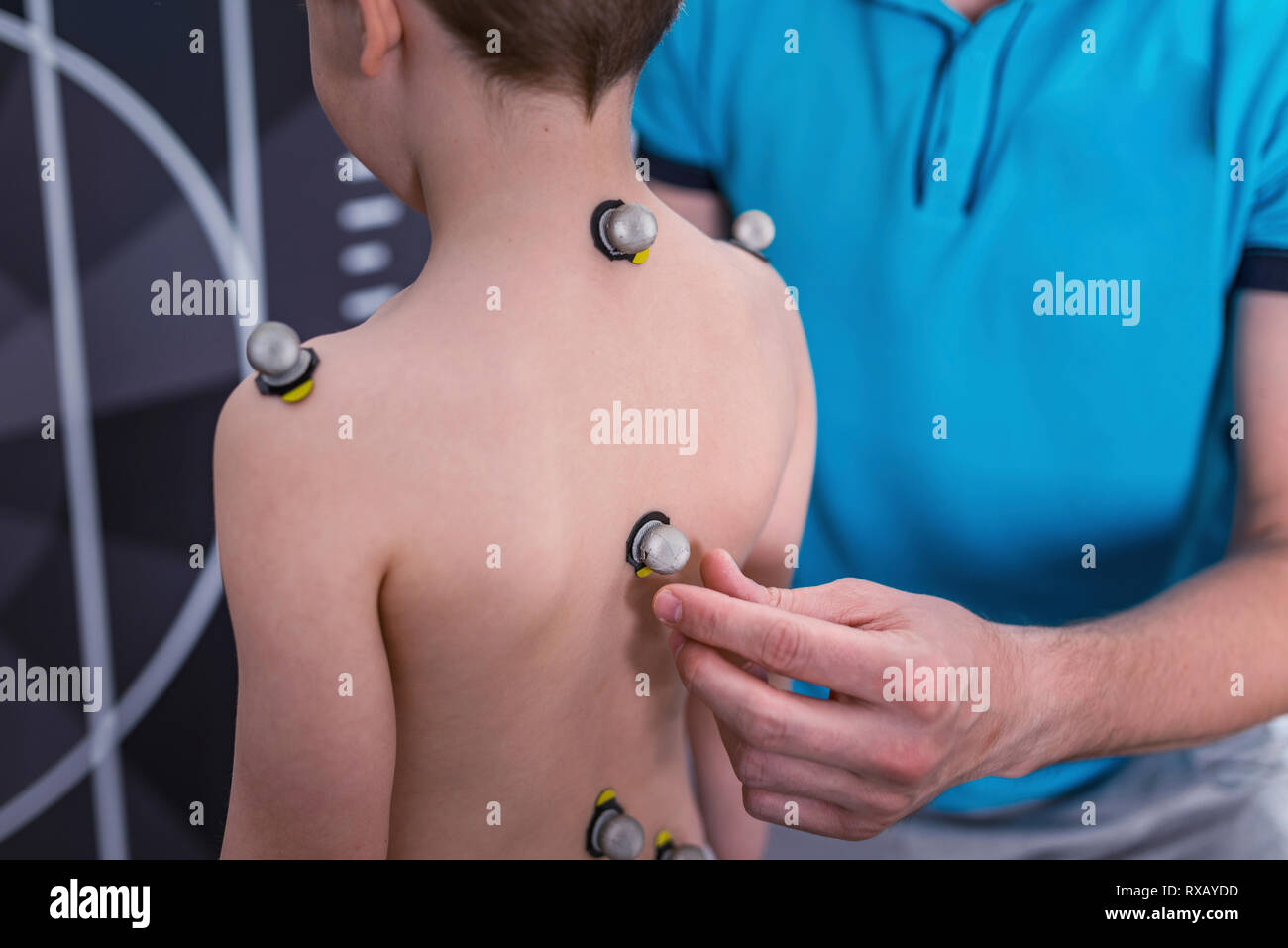 Placing markers for posture analysis Stock Photo