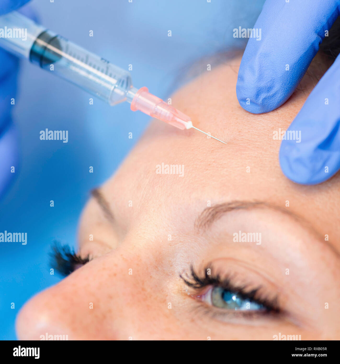 Botox healthcare hi-res stock photography and images - Alamy