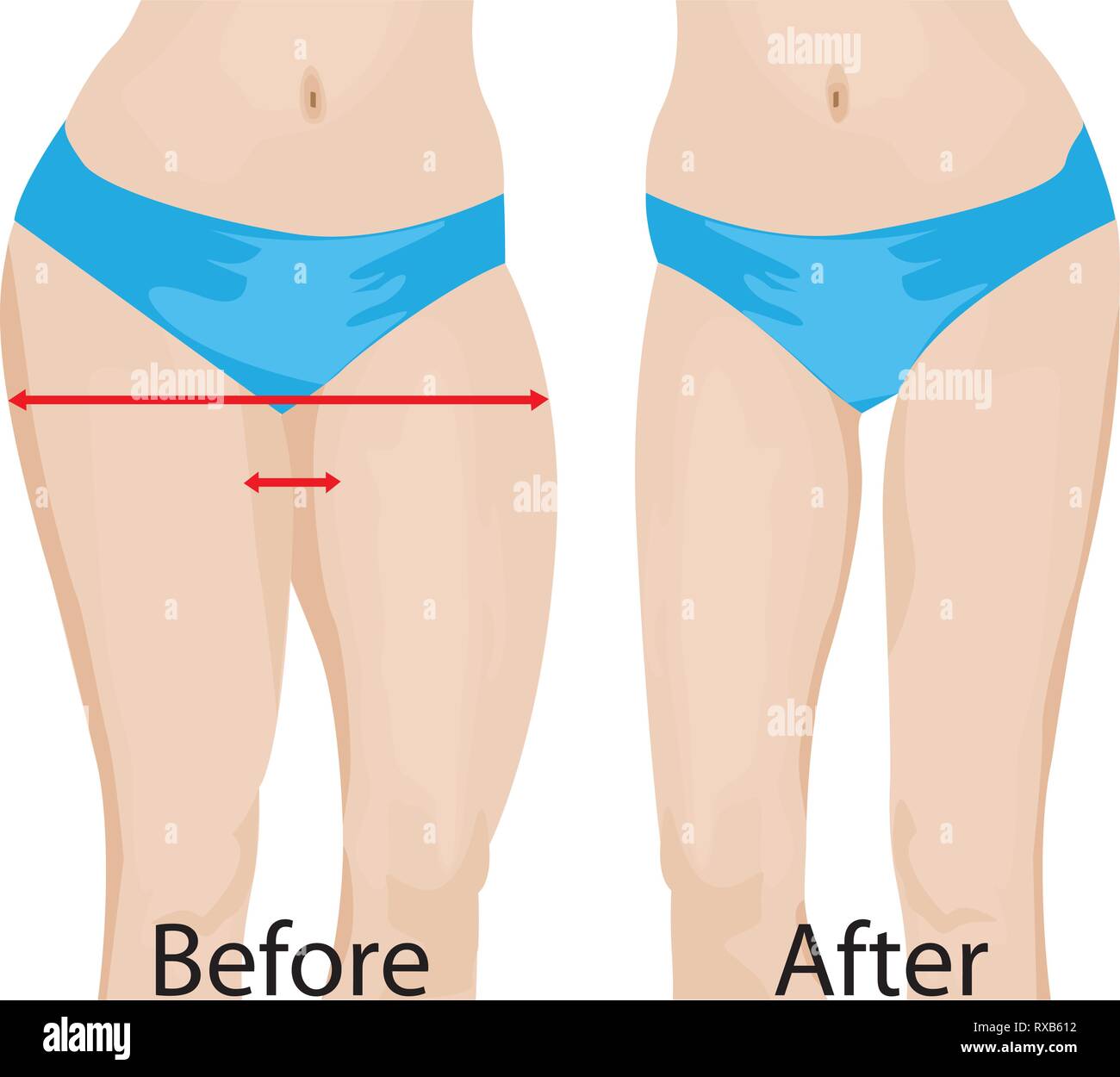 Fat and slim girls' hips. Before and after. vector illusstration