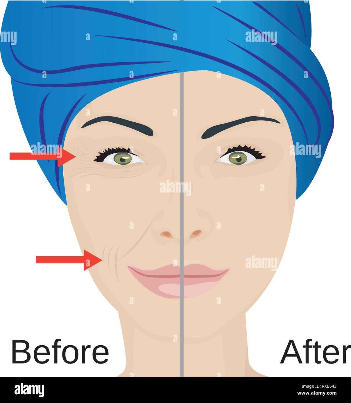 Aging face treatment. Before and after. Rejuvenation, face lifting vector illustration Stock 