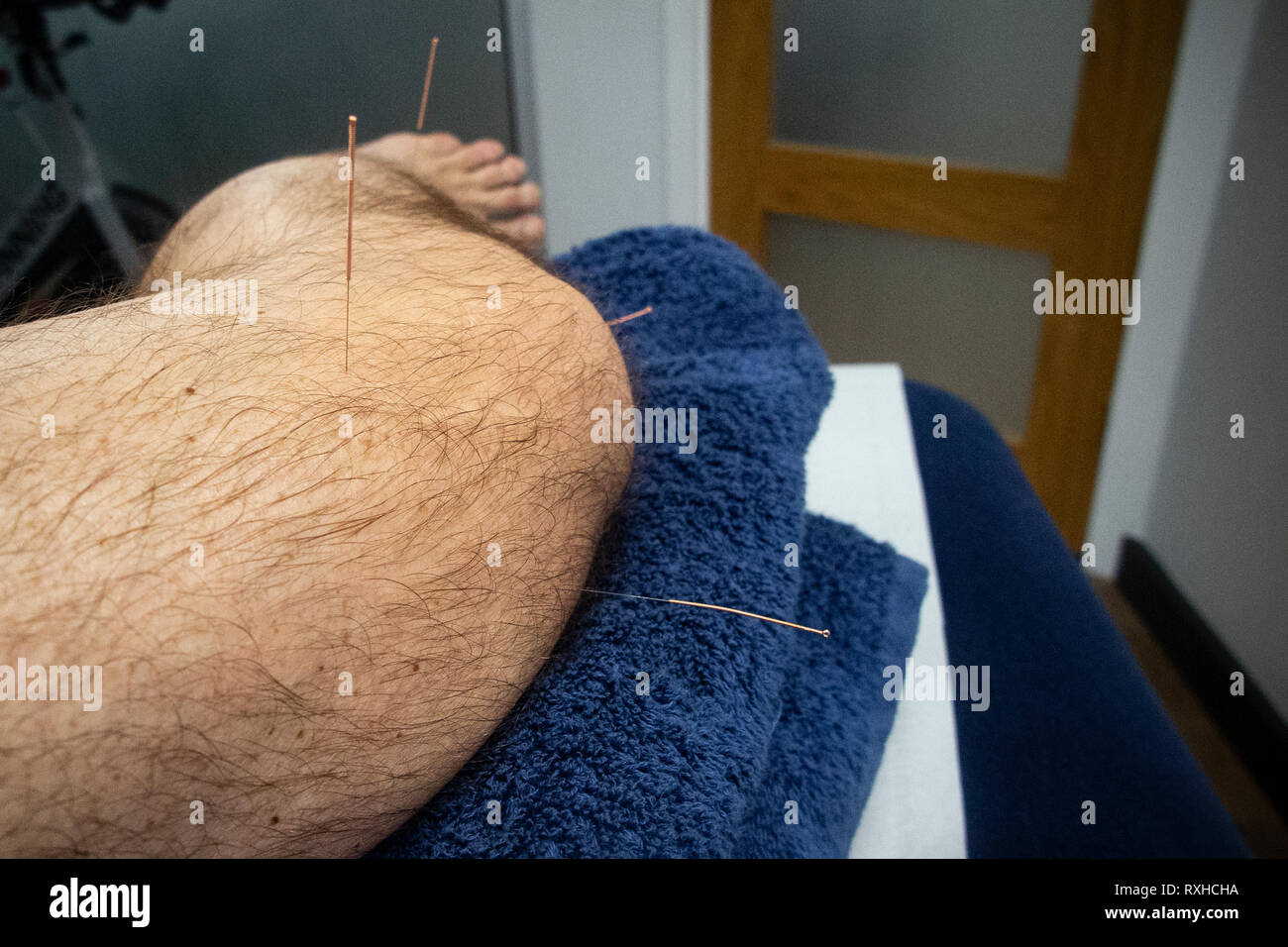 Pins and needles leg hires stock photography and images Alamy