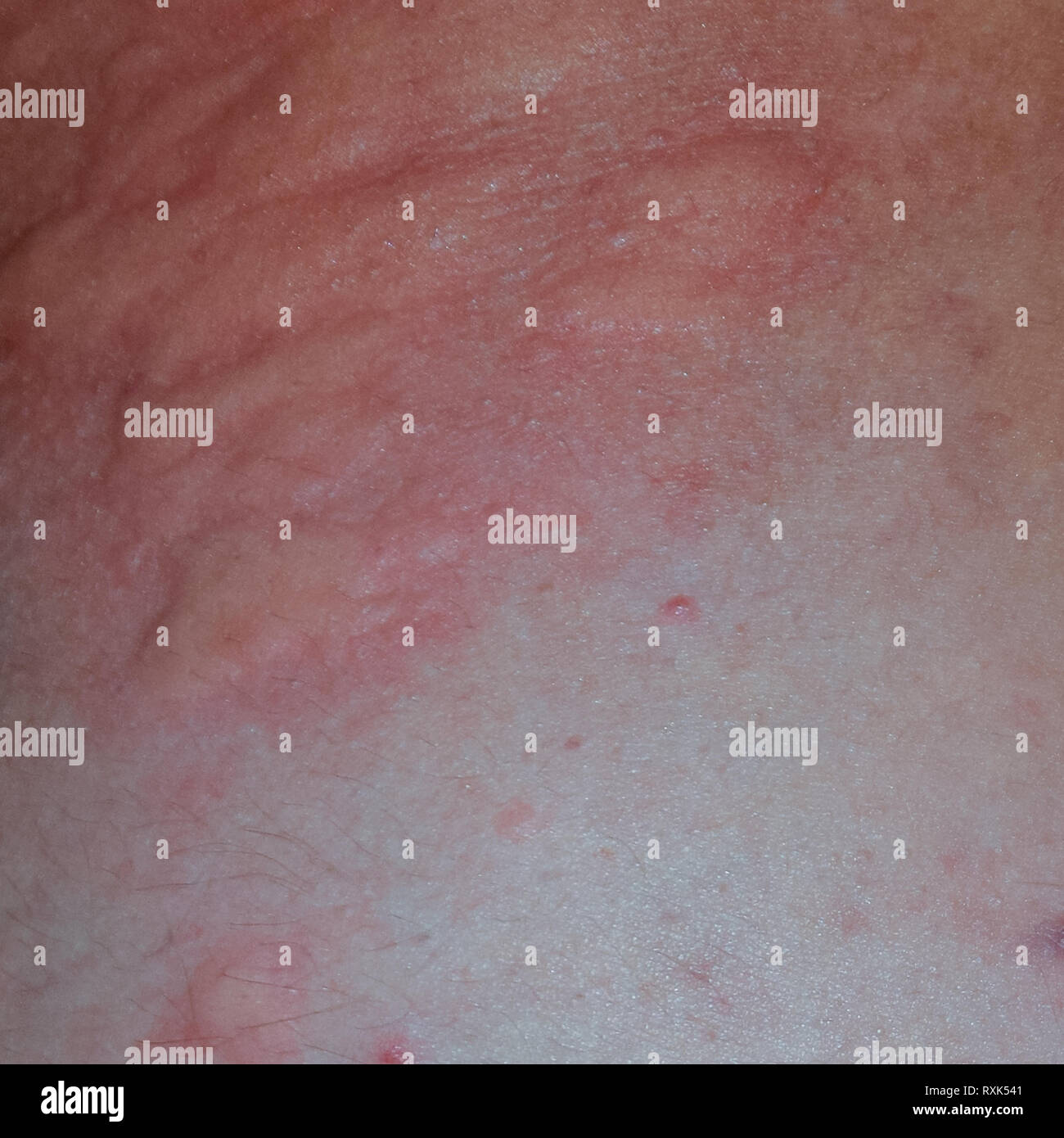My Image 23