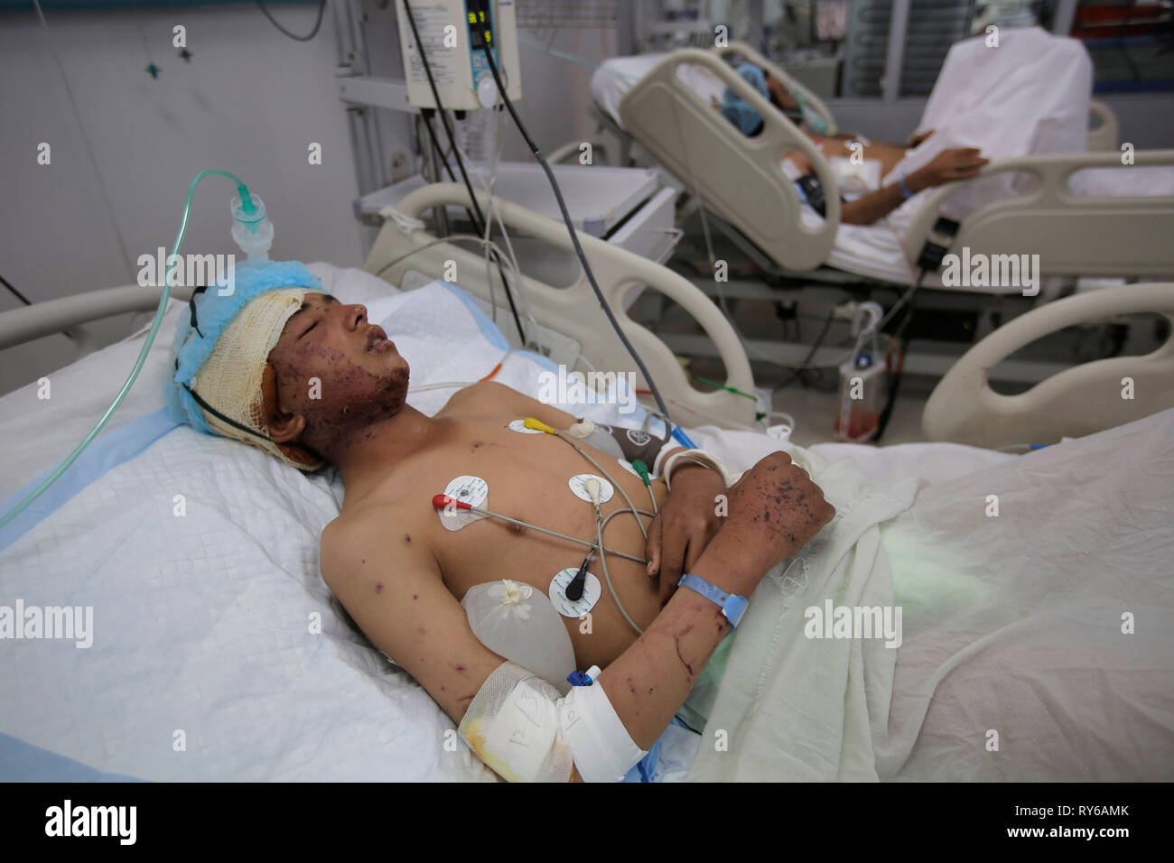 Sanaa, Yemen. 12th Mar, 2019. Yemeni men receive treatment from wounds sustained during a reported air strike at a hospital. Strikes in Yemen killed 22 people during a 48-hour period early this week, including a dozen children, according to the UN. Credit: Hani Al-Ansi/dpa/Alamy Live News Stock Photo