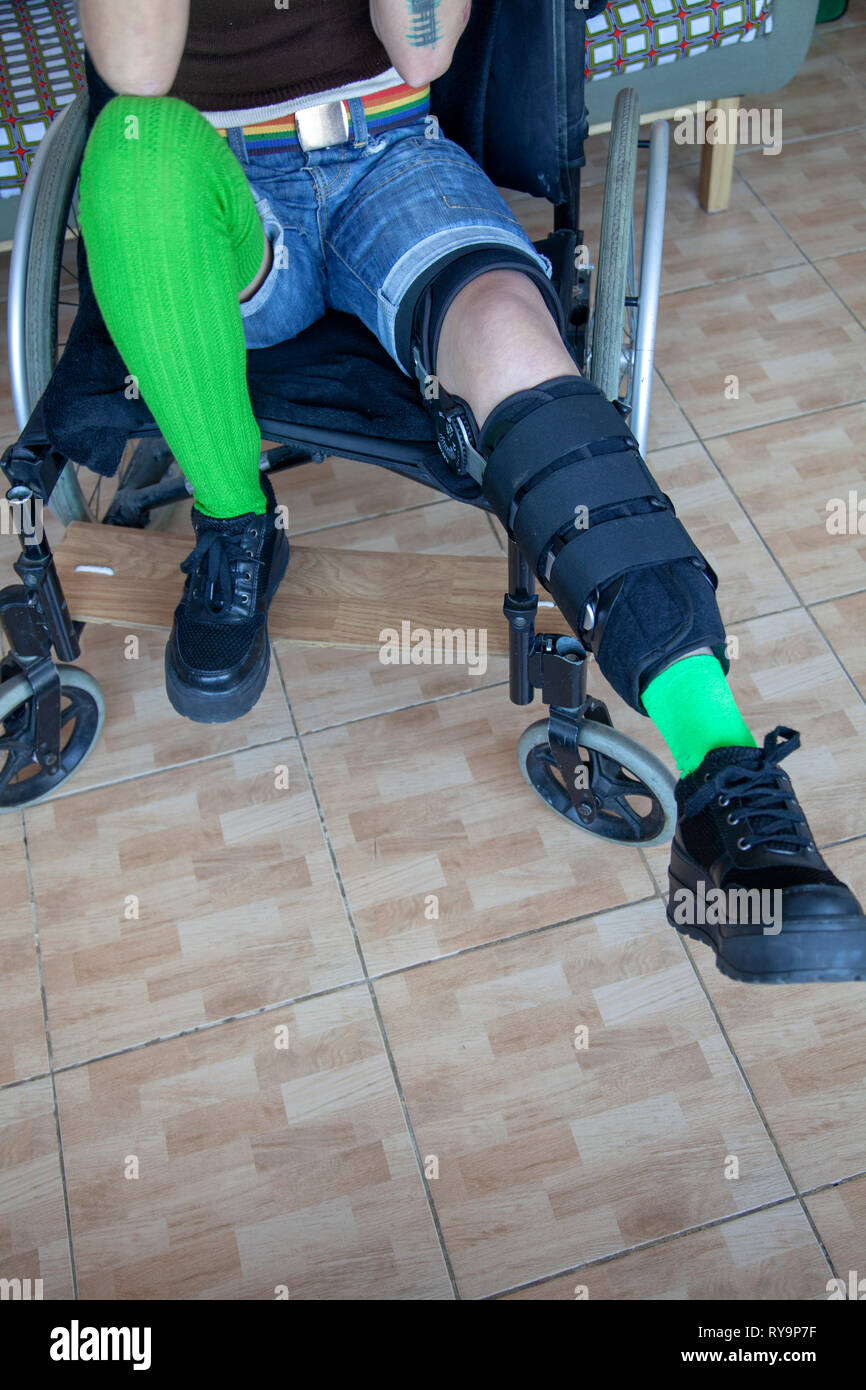 https://c8.alamy.com/comp/RY9P7F/woman-in-leg-brace-in-wheel-chair-RY9P7F.jpg