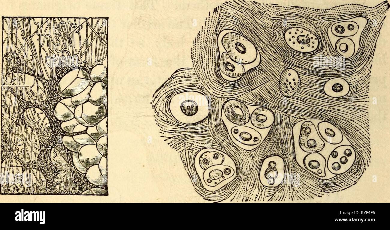 Elementary anatomy and physiology : for colleges, academies, and other schools  elementaryanato00hitc Year: 1869  24 HITCHCOCK'S A NATOM Y surface. This is tlie fibro-cellular membrane or tissue. Its position and character will be better understood when the parts above referred to have been described in subsequent sections. Fig. IT. Fig. 18.    3. Cellular Tissues. 71. Fat and Cartilage.—These embrace the adipose tis- sues, Fig. 17, and the cartilaginous, Fig. 18. The first is the usual form of fat, wherever it occurs in the system. It retains the pure form of the primitive cells. In cartilage Stock Photo