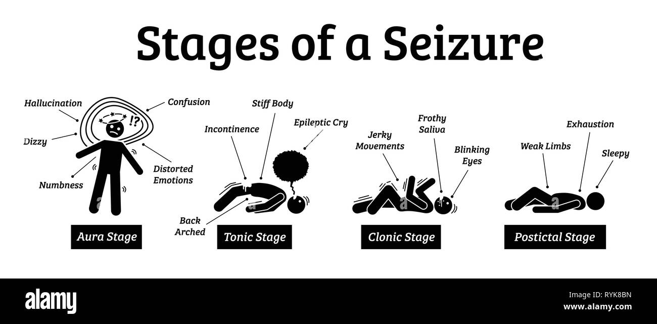 Stages and phases of a seizure. Illustrations depicts the phases when a person get a seizure which are the aura, tonic, clonic, and postictal stages. Stock Vector