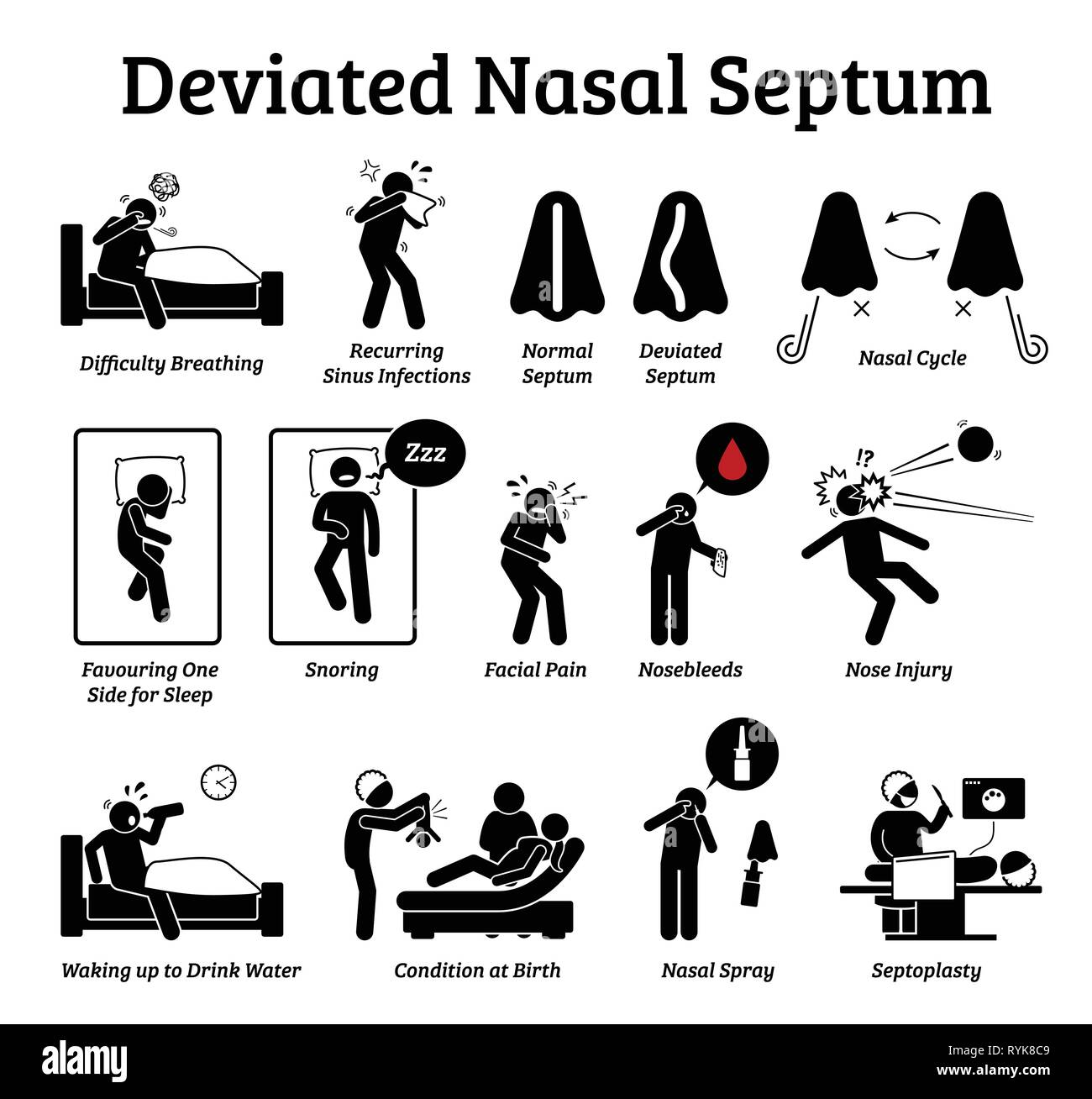 Deviated nasal septum icons. Illustrations depict signs and symptoms of nose problem. Difficulty breathing, sinus infection, snoring, and facial pain. Stock Vector