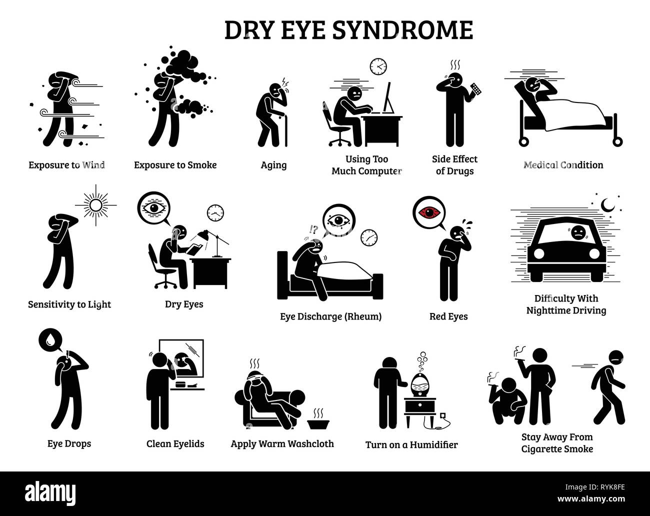 Dry Eye Syndrome. Icons illustrations depict  the symptoms, causes, effects, and home remedies for dry eye health problem. Stock Vector