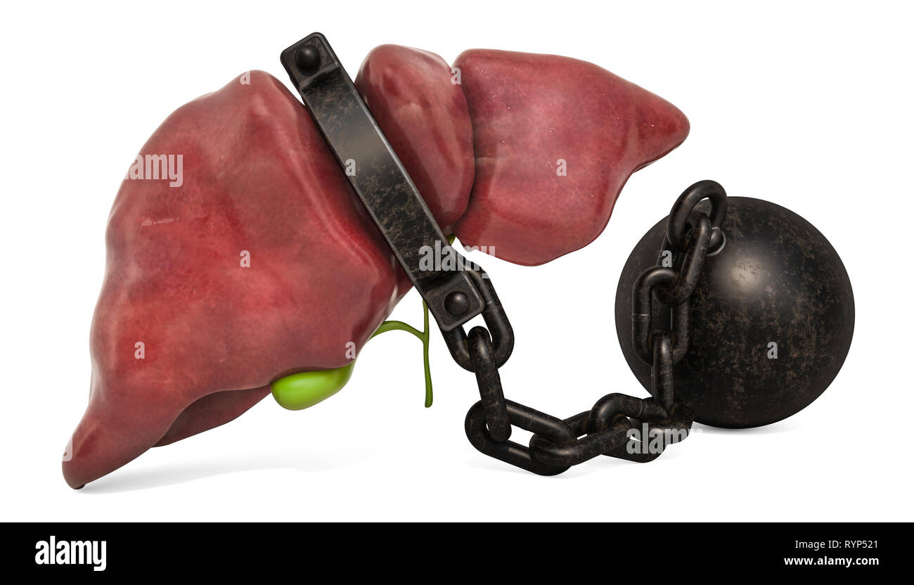 Liver Pain concept. Human liver with shackle. 3D rendering isolated on white background Stock Photo