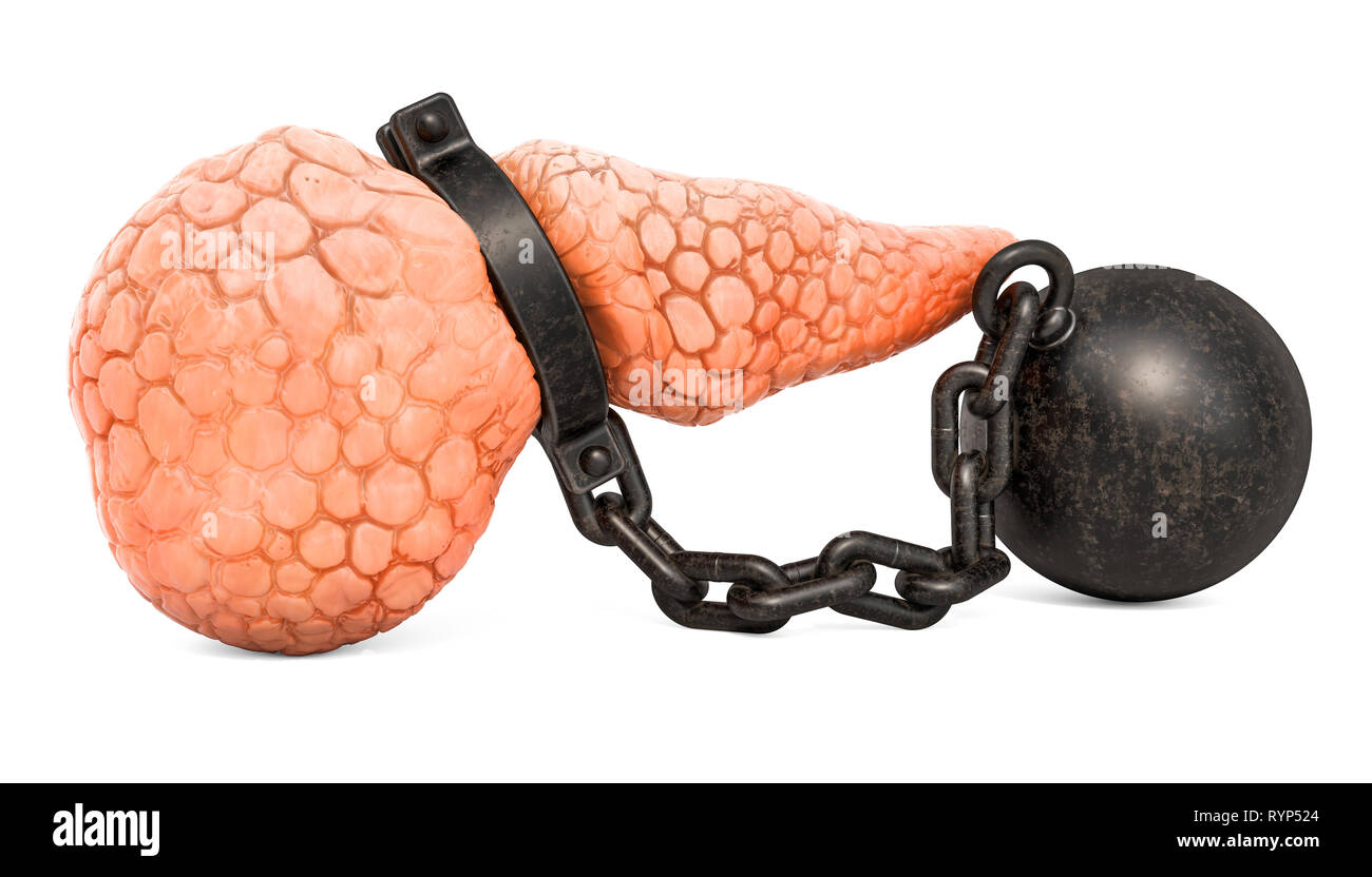 Pancreatic disease, pancreatic pain concept. Human pancreas with shackle. 3D rendering isolated on white background Stock Photo