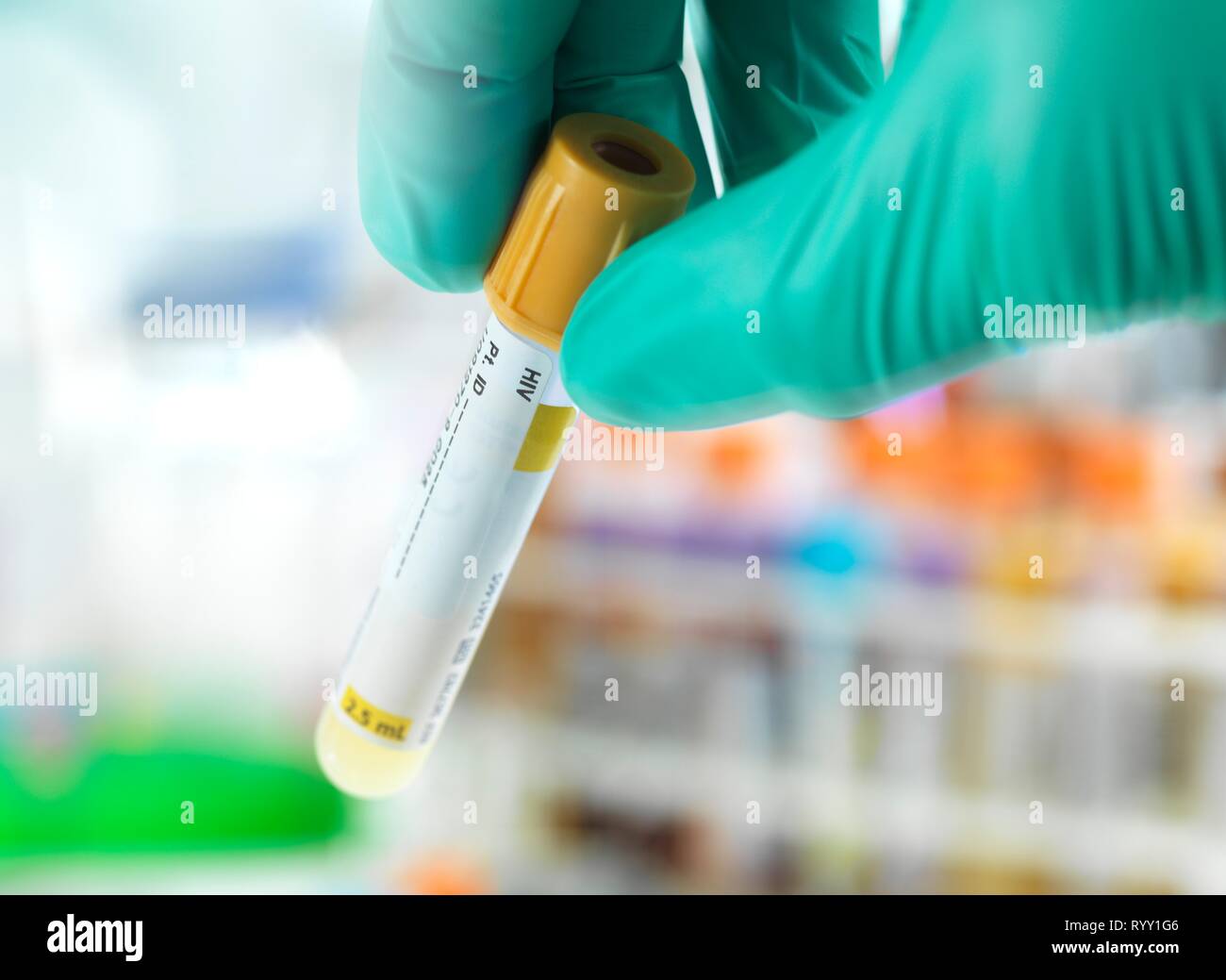 Doctor preparing a HIV test sample for testing in the laboratory Stock