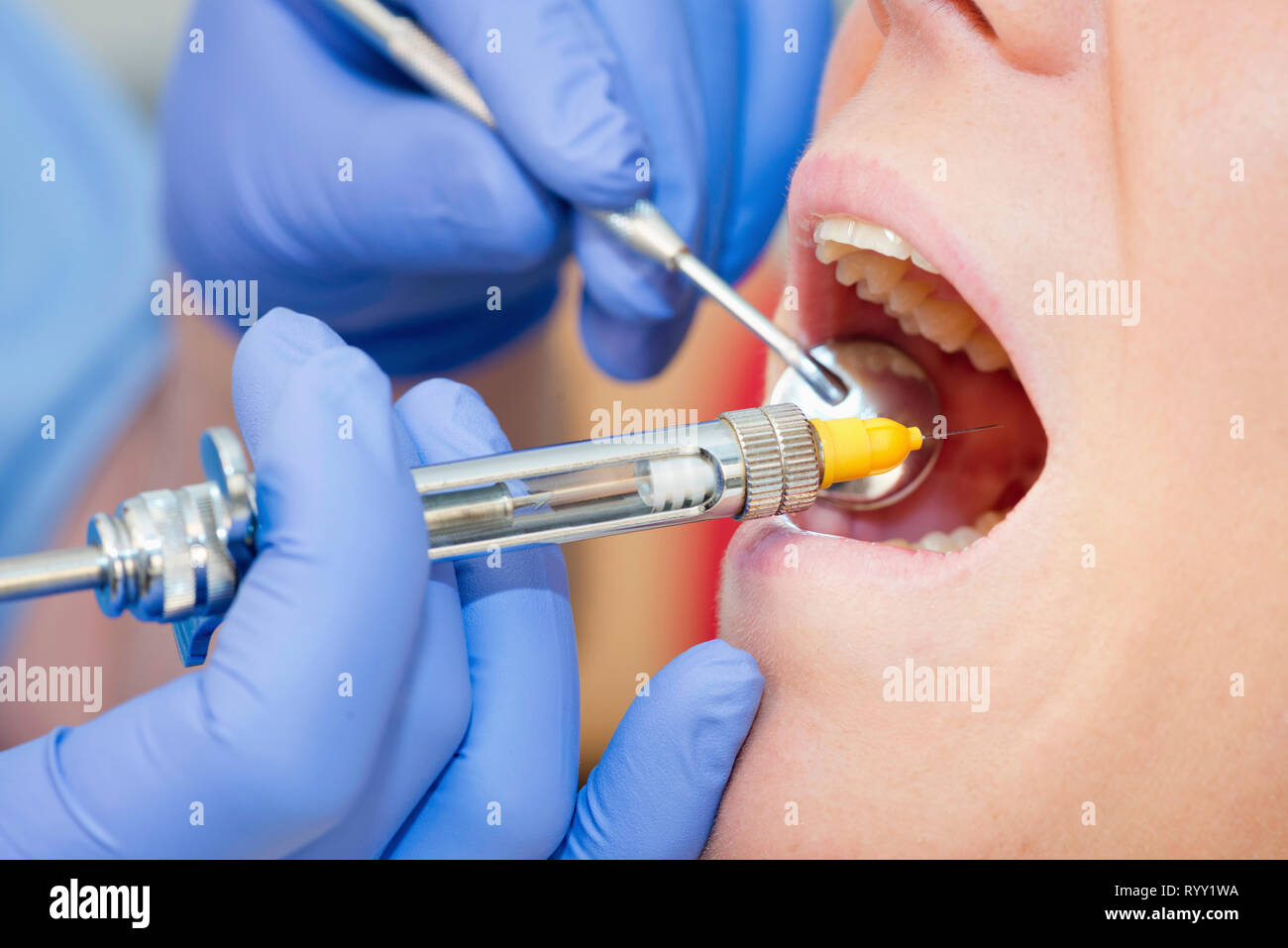 Dental Anaesthesia Stock Photo Alamy