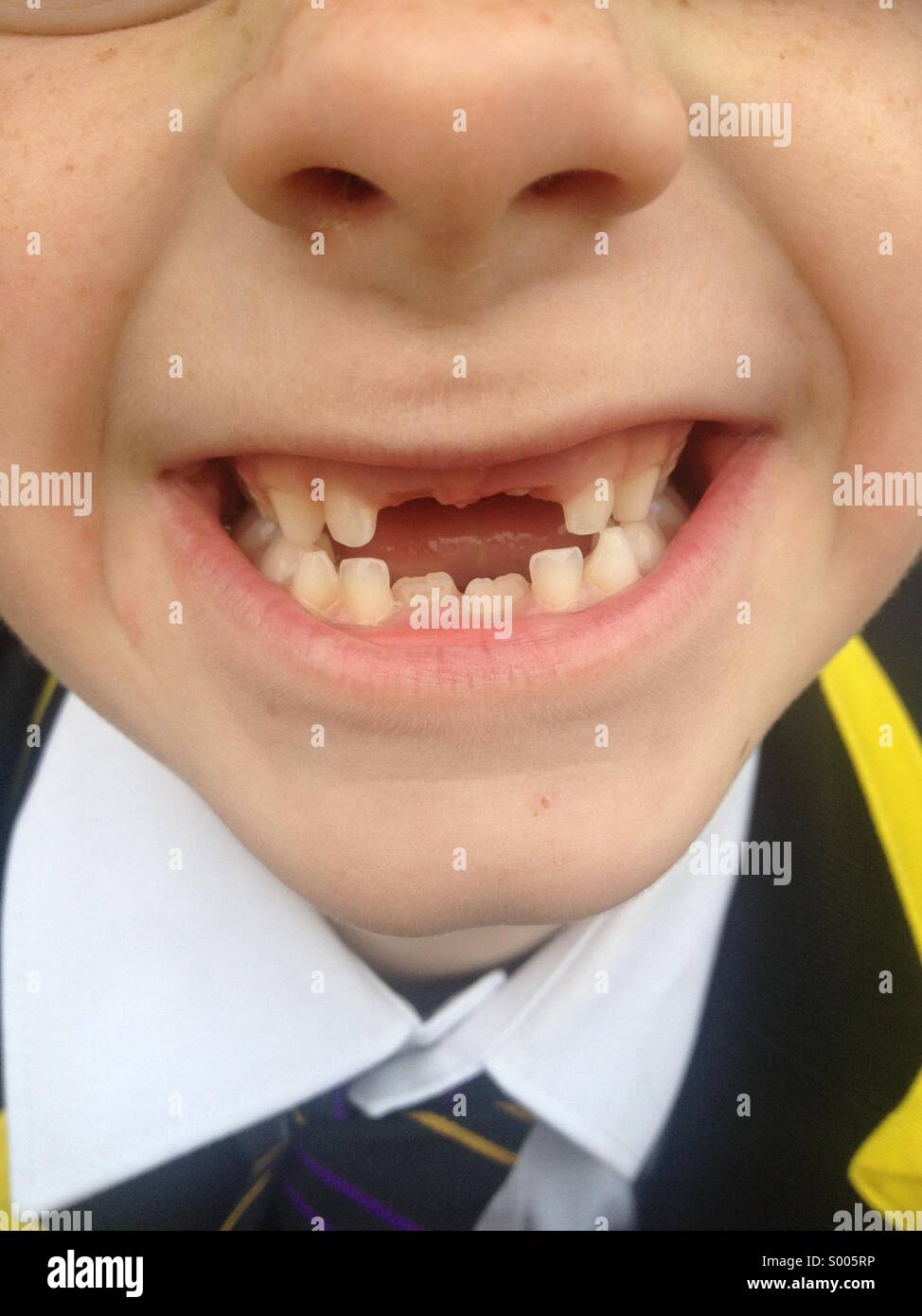 No Front Teeth Stock Photos & No Front Teeth Stock Images ...