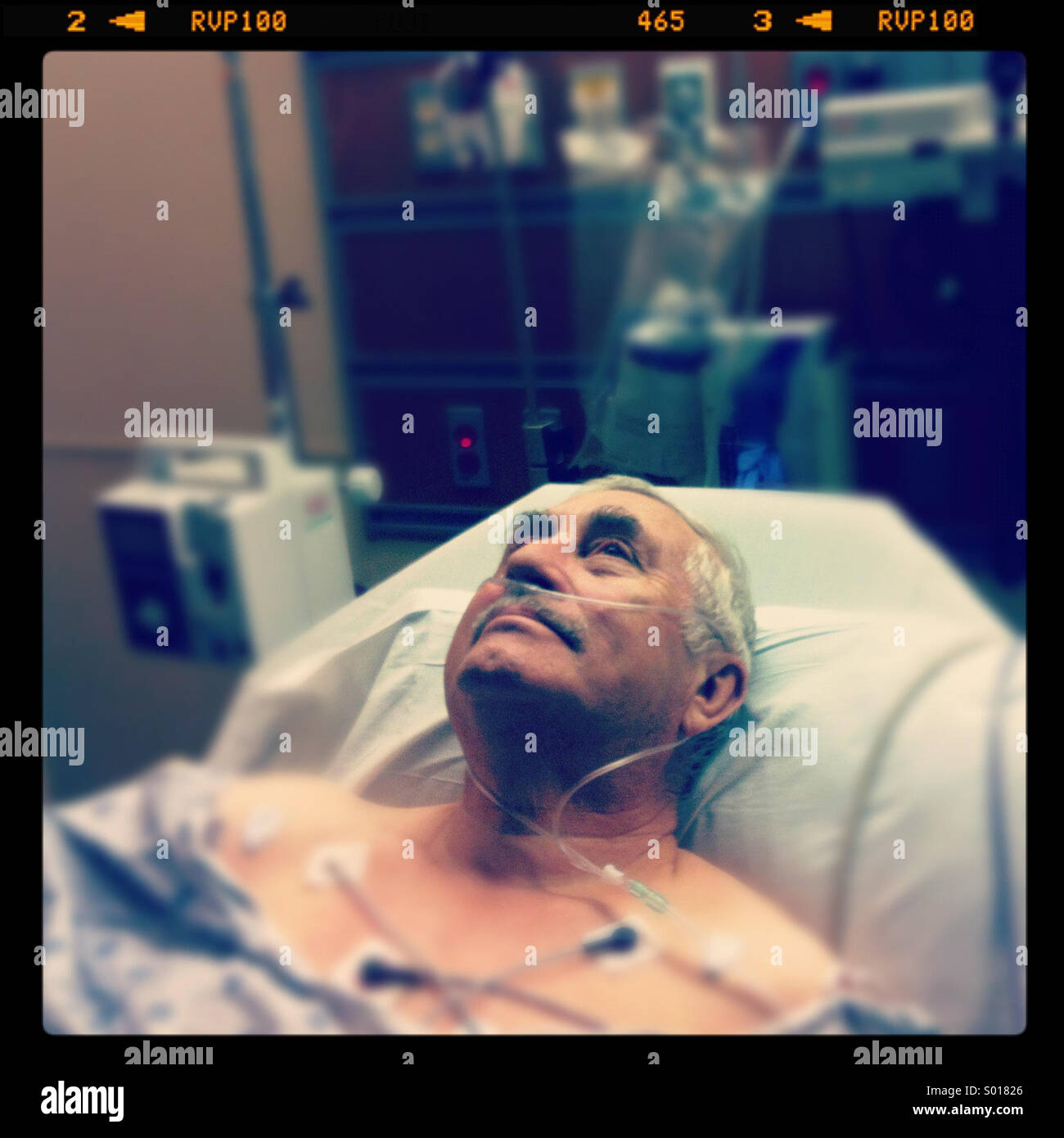 An older man with a mustache lying in a bed in a hospital emergency room, with electrodes attached to his chest Stock Photo