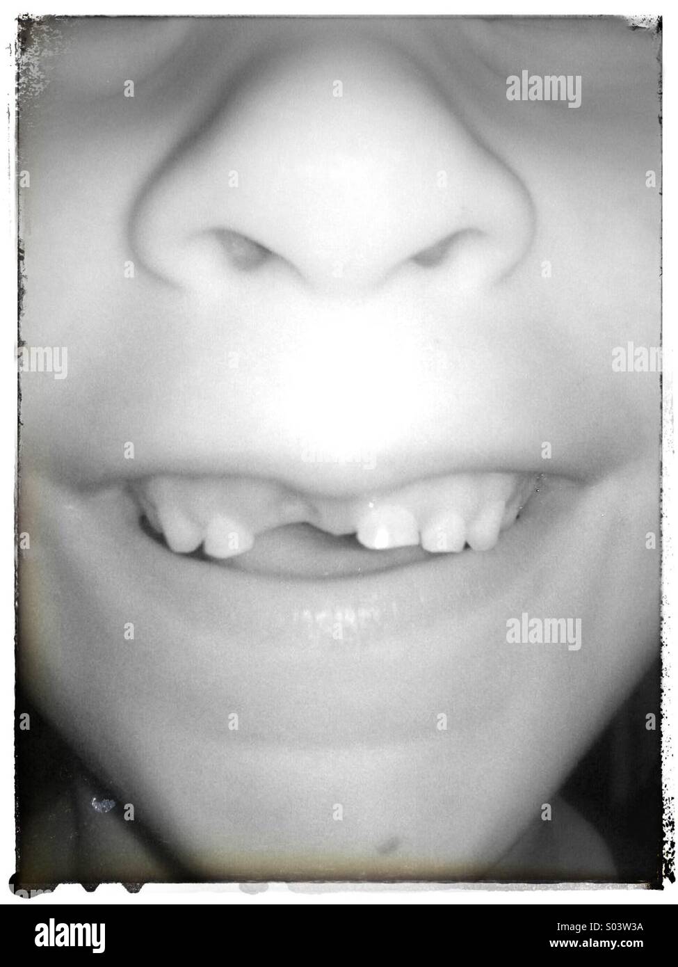 Child with missing tooth. Stock Photo