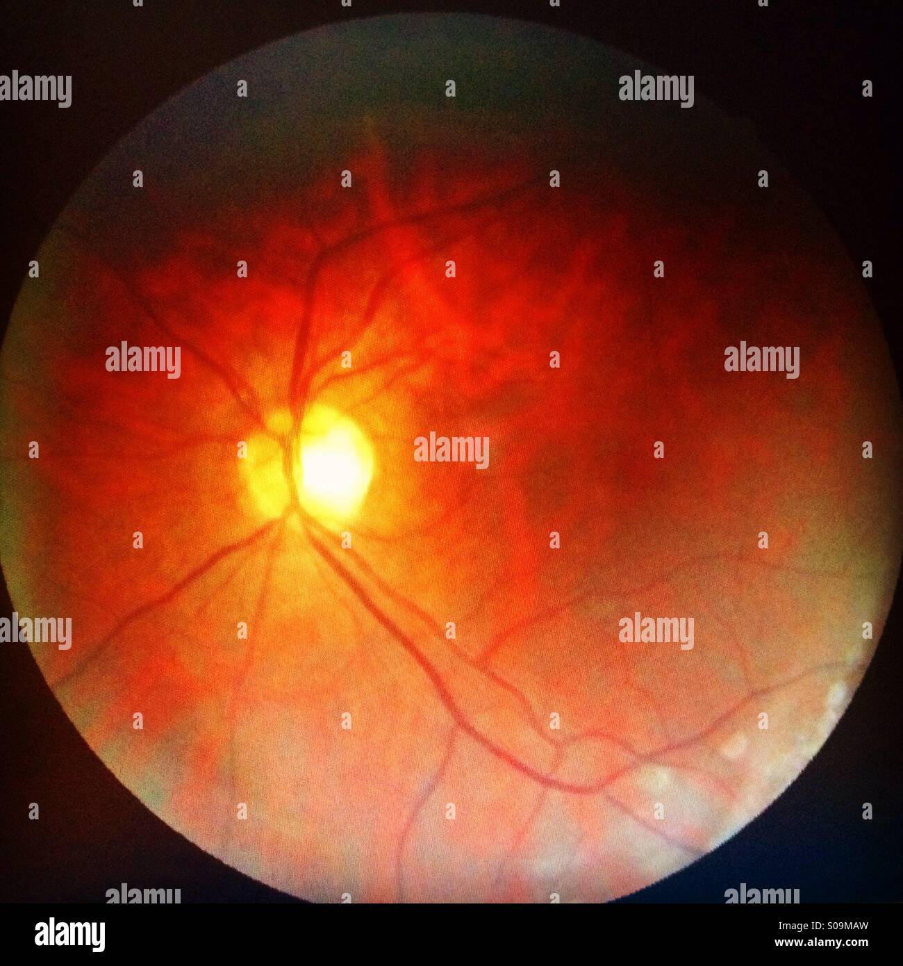 The inside of an eyeball Stock Photo