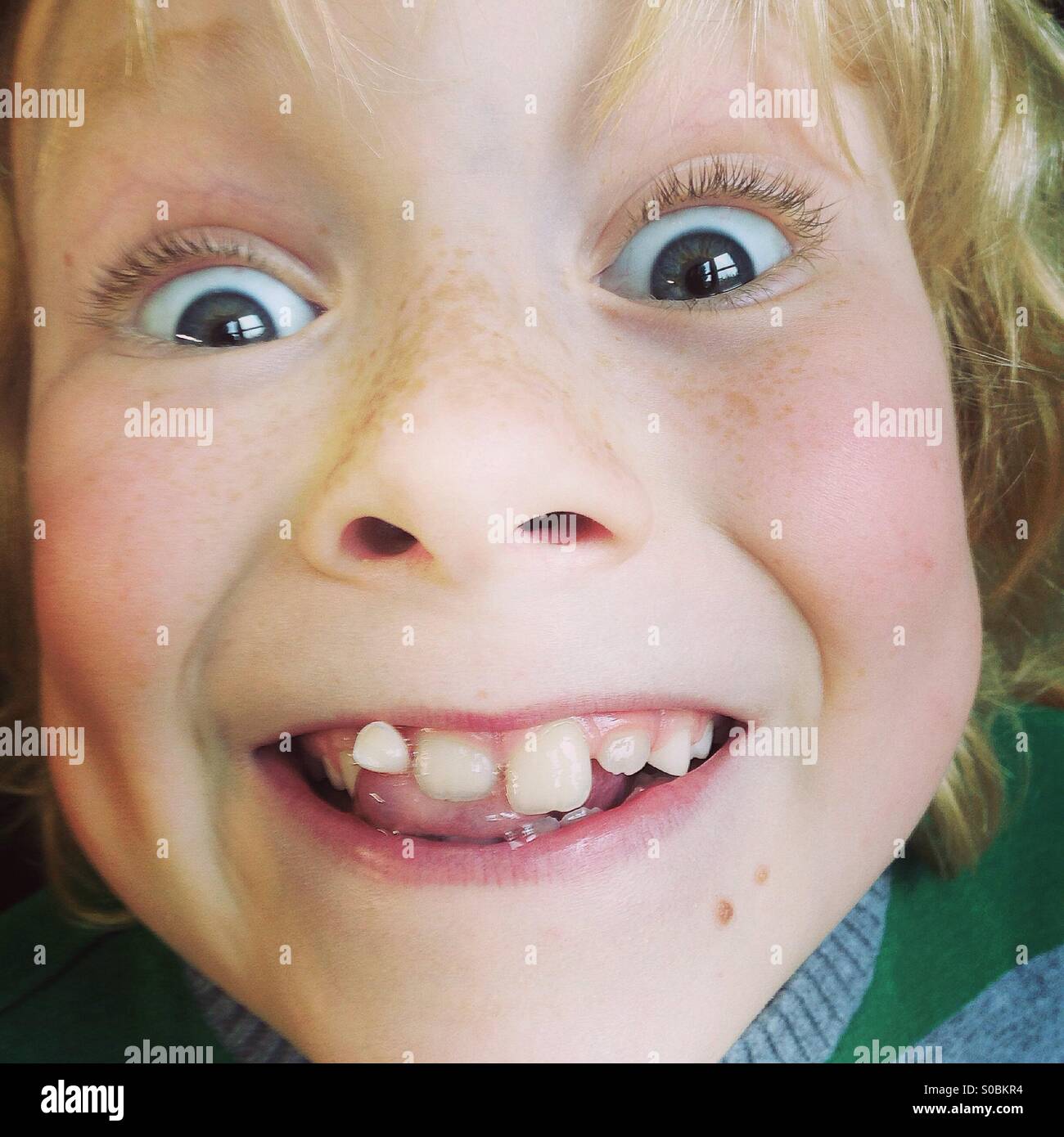 Teeth falling out hires stock photography and images Alamy