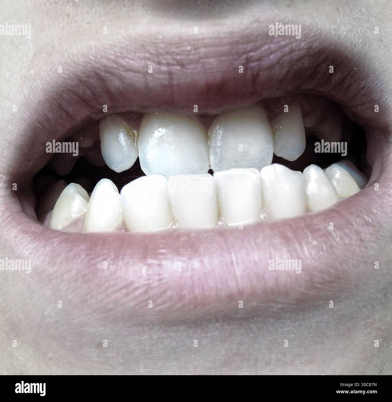 Clouse up of male mouth with strong healthy teeth - Smartphone Captured Stock Image